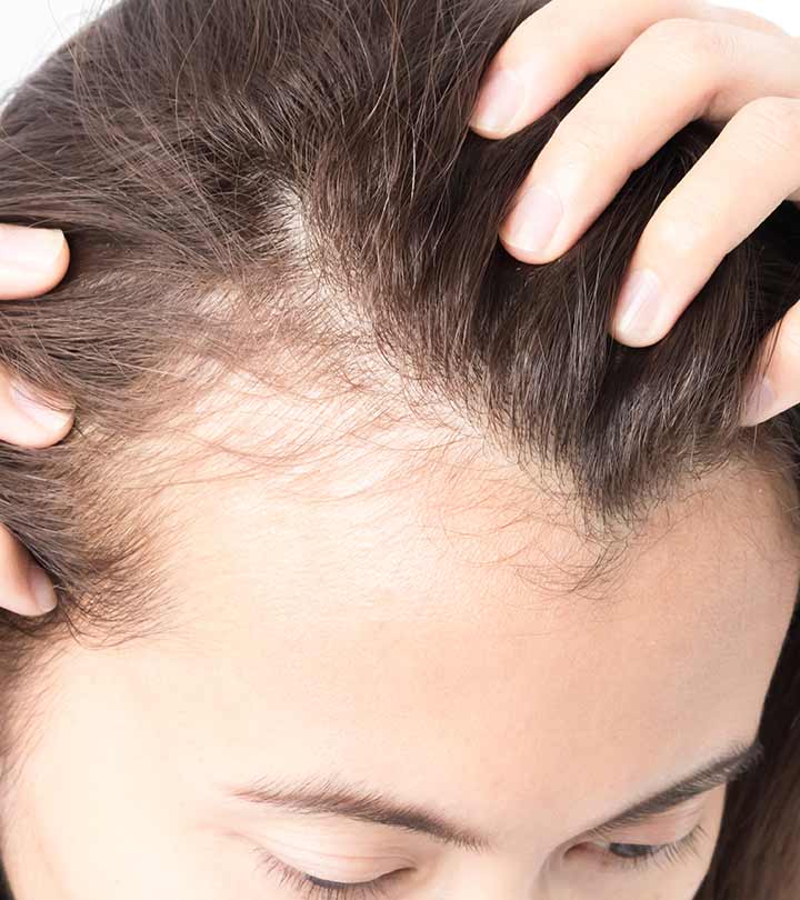 How to stop hair deals loss and regrow hair naturally