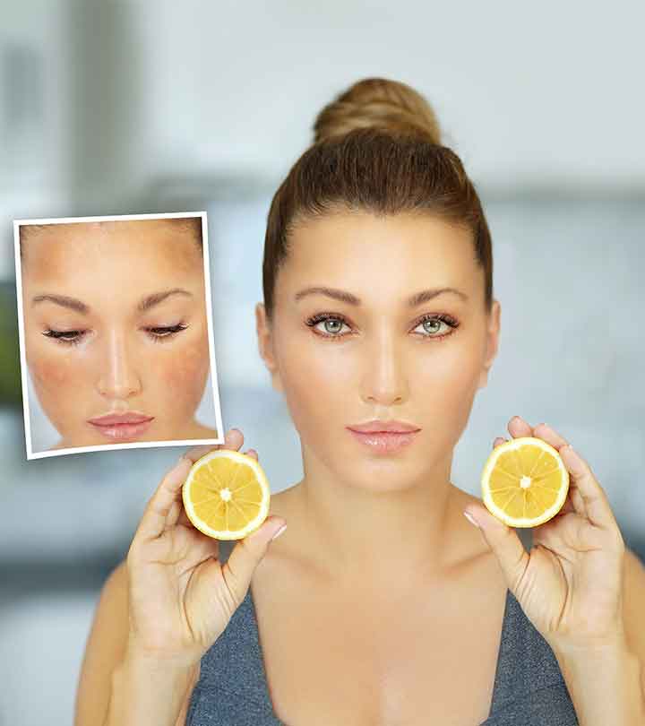 How To Use Lemon Juice For Dark Spots On Face – 9 Natural Ways